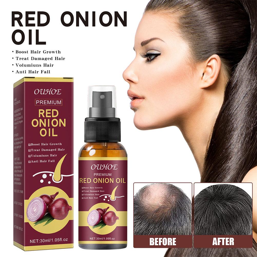 1/2/3pcs Red Onion Essential O - Hair Care With Rice Water avis et prix