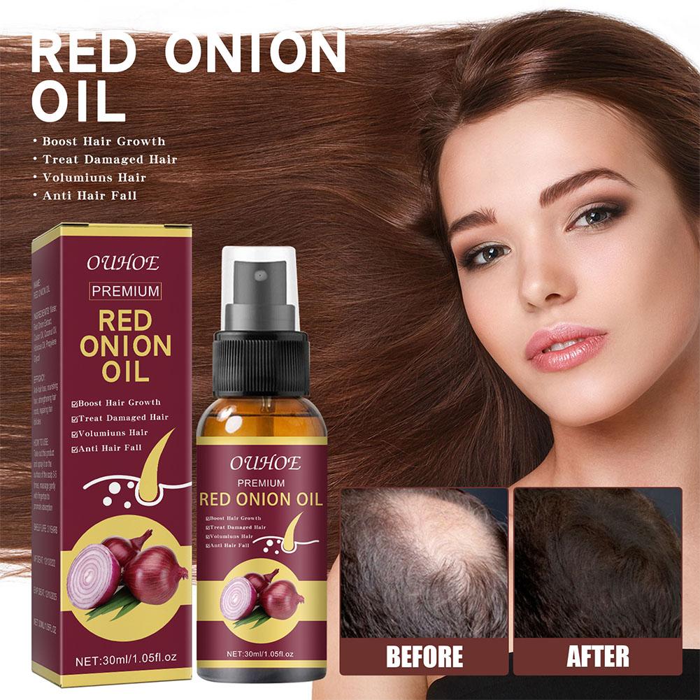 1/2/3pcs Red Onion Essential O - Hair Care With Rice Water avis et prix