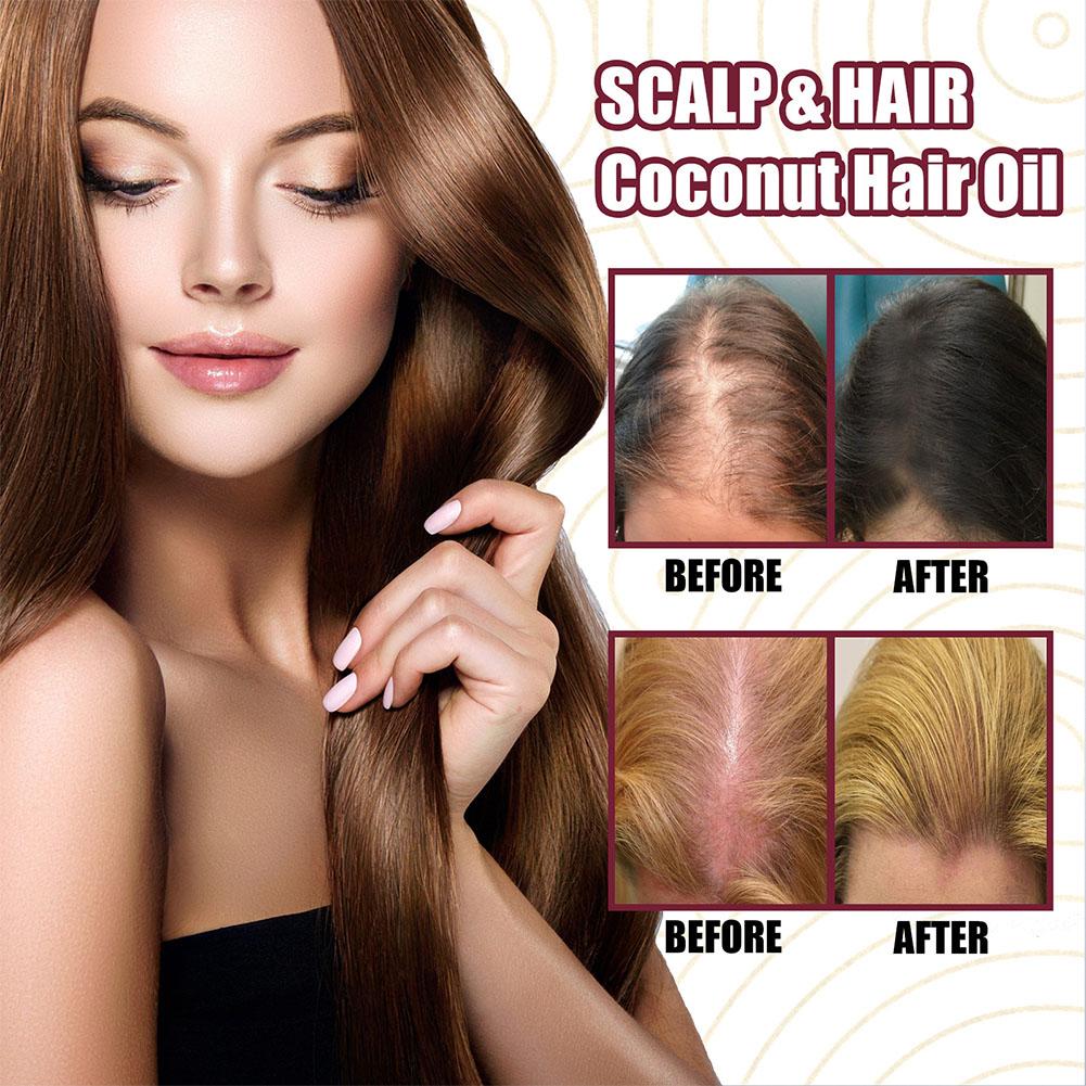 1/2/3pcs Red Onion Essential O - Hair Care With Rice Water avis et prix