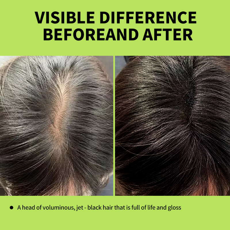 Green Apple Black Hair Dye Sha - Hair Care Herbal avis et prix