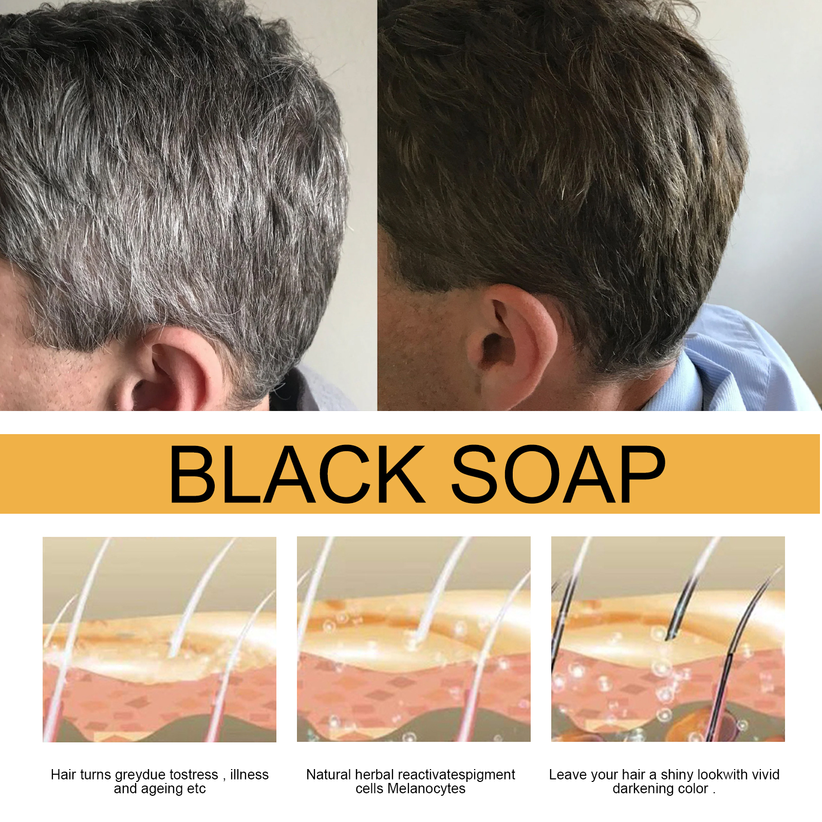 Hair Shampoo Soap Polygonum Mu - Hair Care Herbal avis et prix