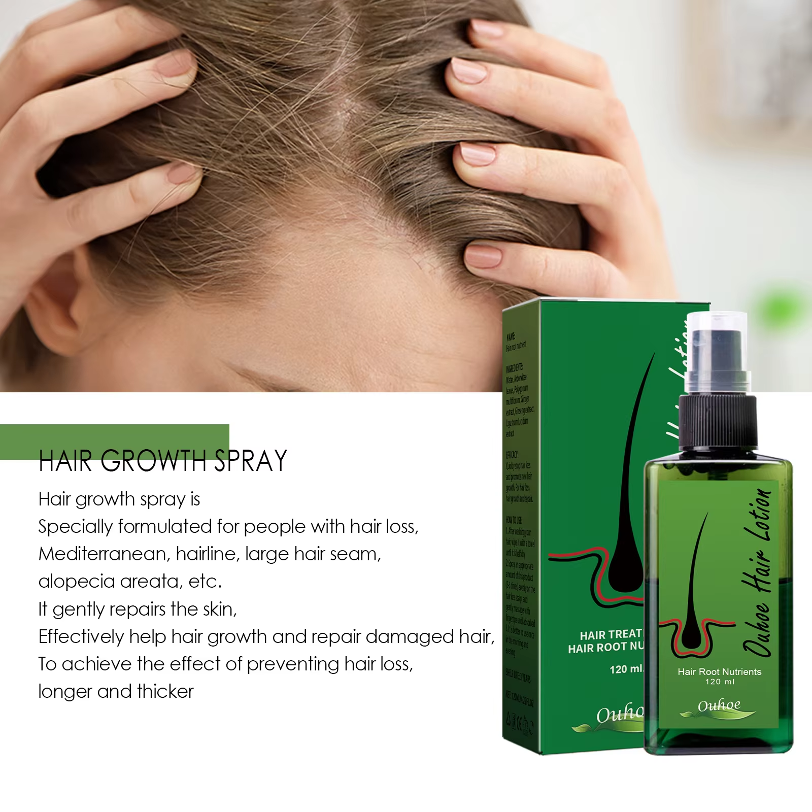Hair Growth Spray Anti Hair Lo - Hair Care Herbal avis et prix