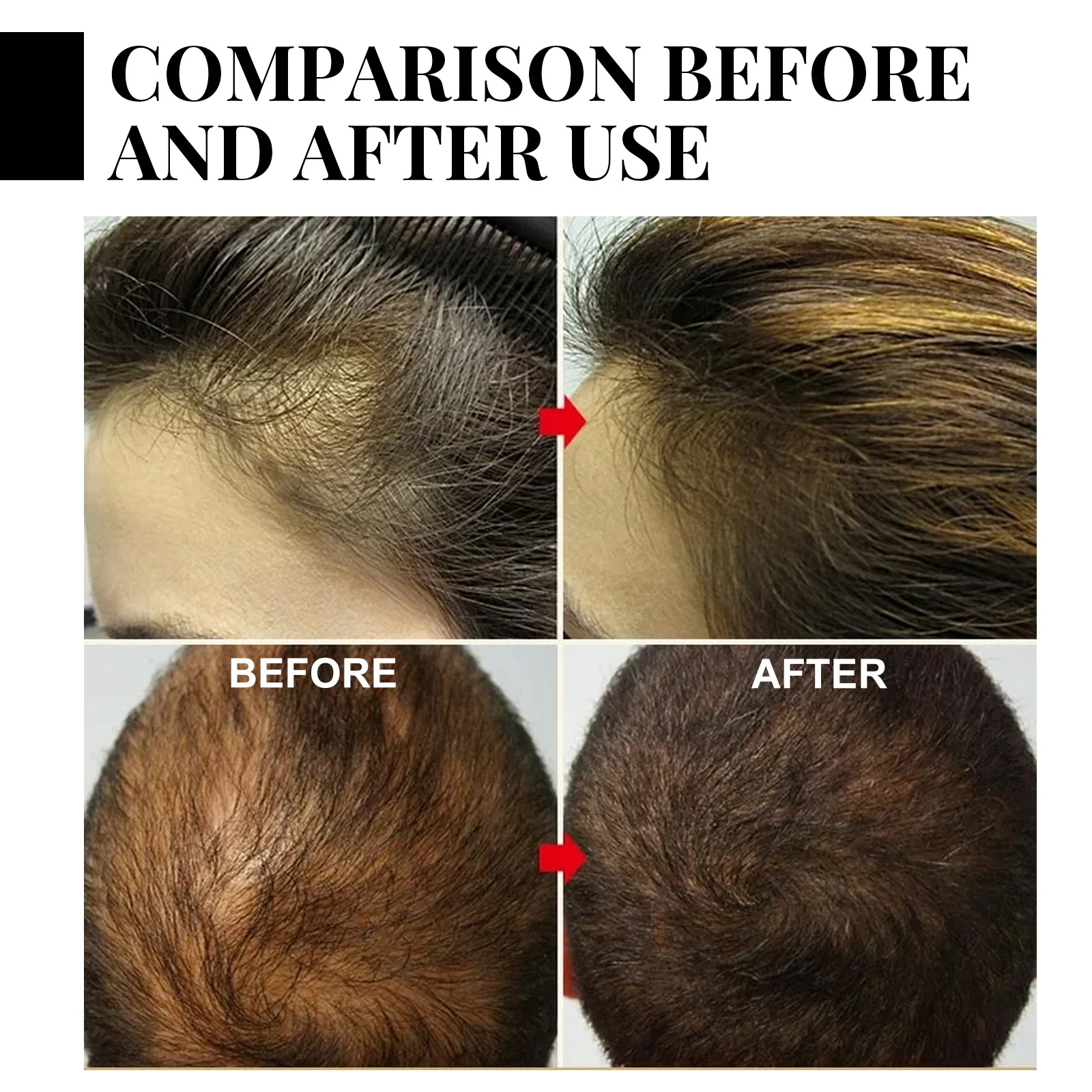 Ginger Hair Growth spray Anti  - Hair Care Herbal avis et prix