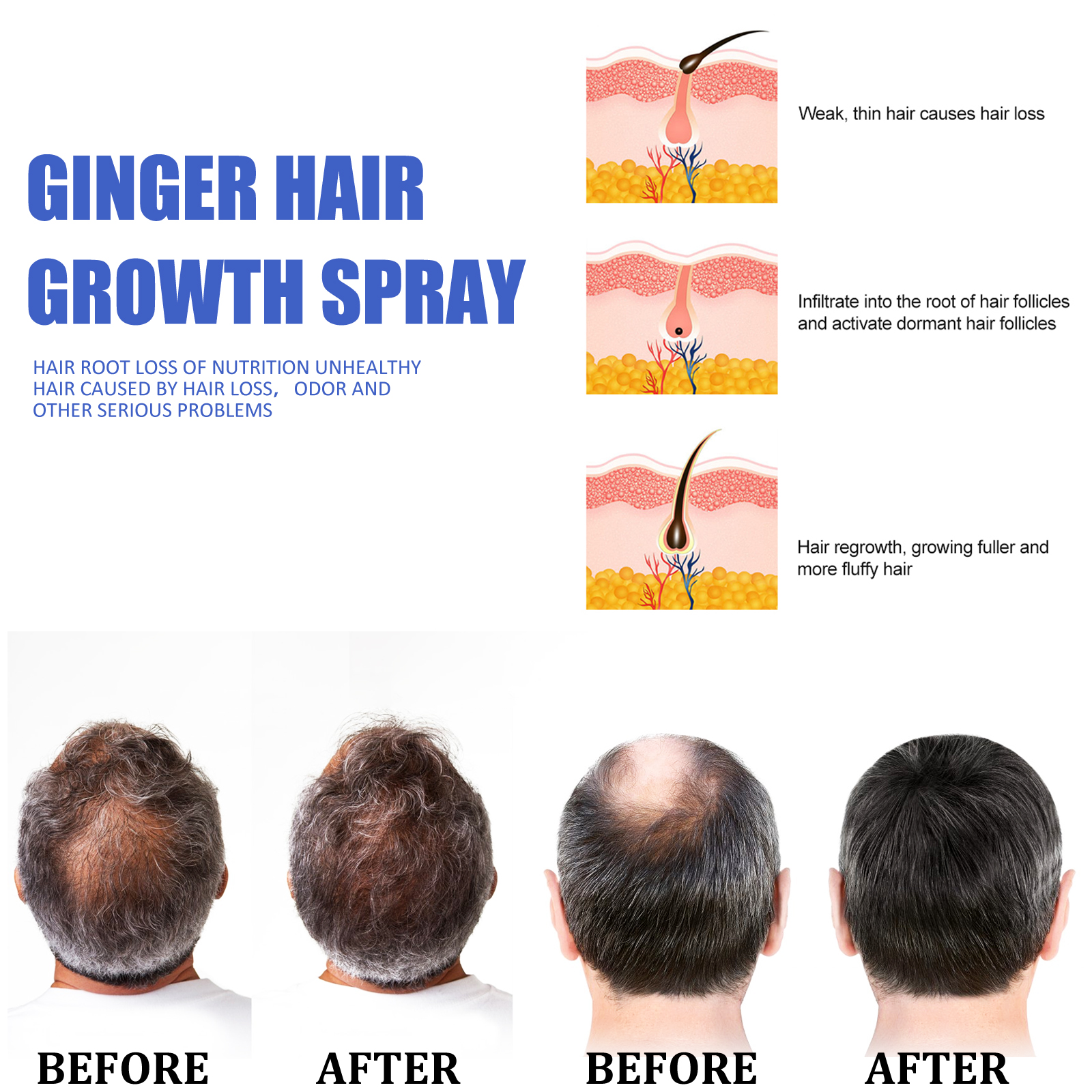 Ginger Hair Growth spray Anti  - Hair Care Herbal avis et prix